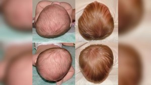 bimbo_cranio_2
